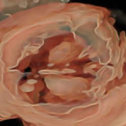 Нейросонография Диагностика мозга плода 3D/4D/5D