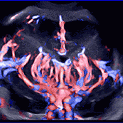 Комплексное УЗИ 2Щитовидная железа, Брюшная полость,,Молочные железы(ж),Органы малого таза, Почки   Сосуды головы,    Сосуды мозга   УЗИ сердца